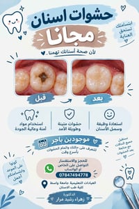 حشوات مجانية • كلية طب الاسنان • دكتورة زهراء