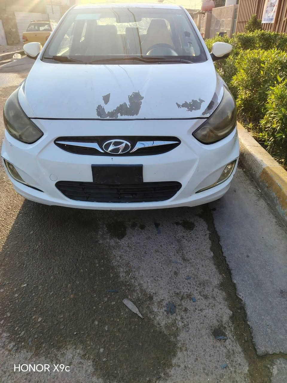 سلام عليكم اكسنت خليجي ٢٠١١ رقم بغداد  محرك ١٦٠٠ دبل قطره بلو
بدون حادث صبغ قطعتين ونص 
السعر ٧٨
***********
