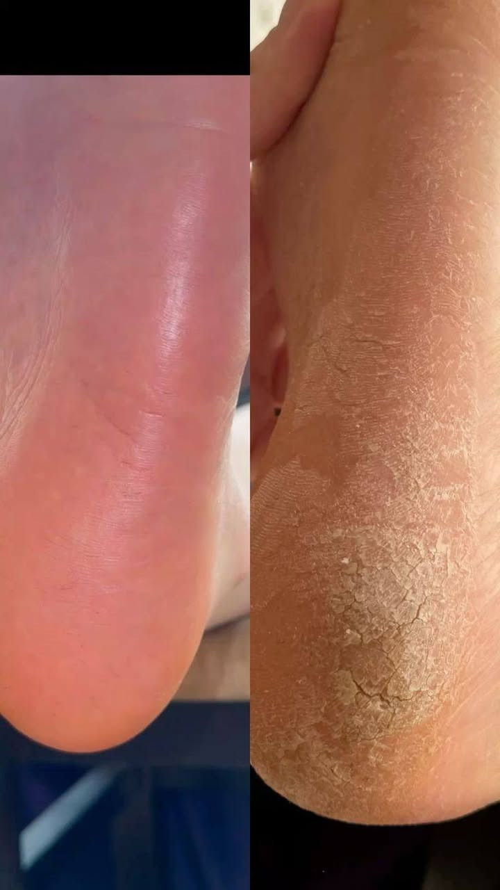 بنات خدمه منزليه نجيكم للبيت
شيرة جسم كامل + مقشر للجسم 
حفافه وجه
تنضيف بشره
 تنضيف قدم
كل ه̷̷َـَْـُذآ ب50 الف 
وحده الكروه عليج اكثر م̷ـــِْن وحده الكروه علينه

للحجز واتساب
***********
