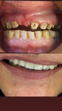 ابتسامة طبيعية • تجميل أسنان • عيادة الرياحين