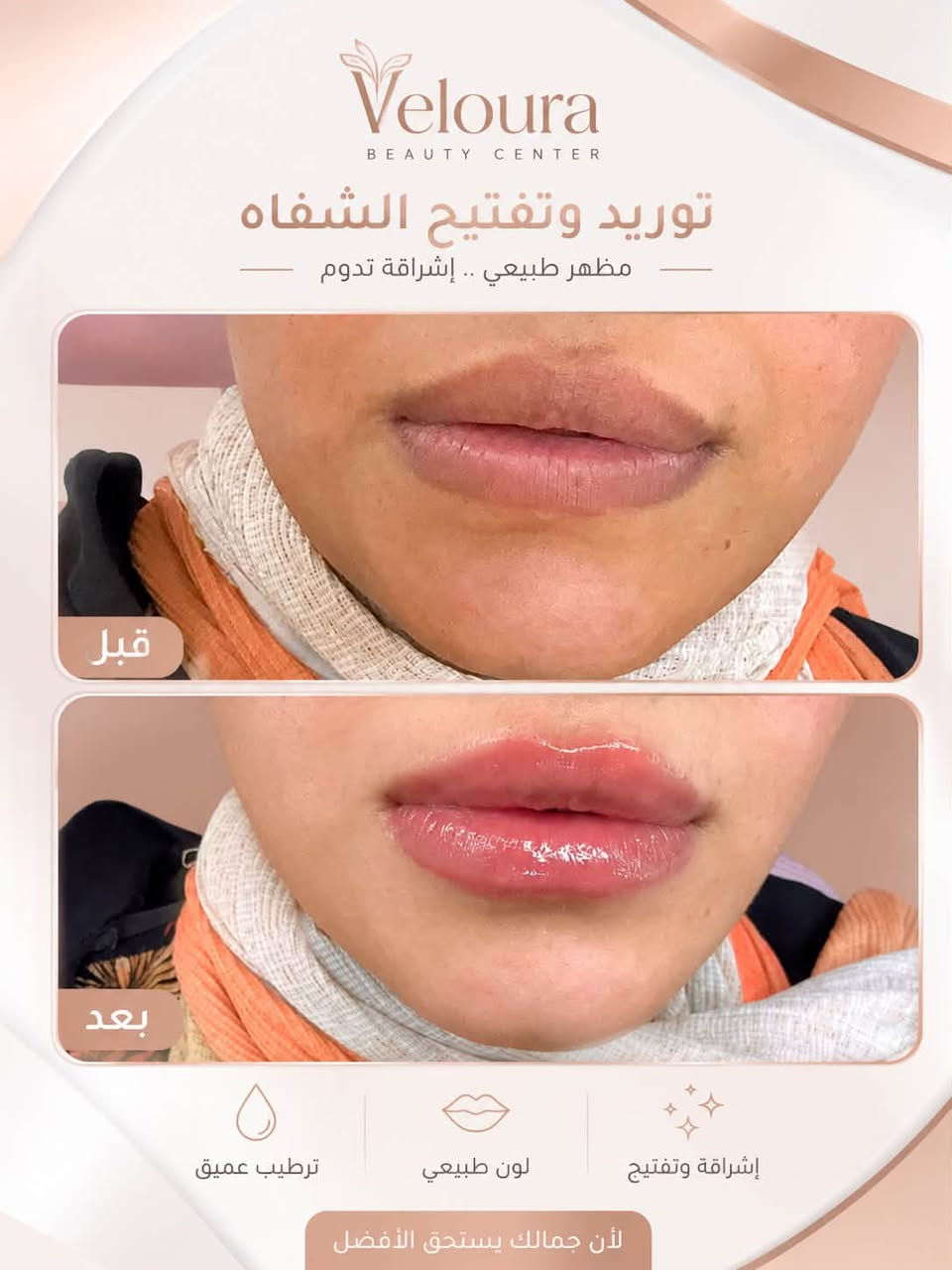 ✨ لأن جمالك يستحق عناية تليق بك ✨

في Veloura Beauty Center جمعنا لكِ كل ما تحتاجينه لإطلالة متكاملة في مكان واحد وبأسعار مناسبة💗
💉 فيلر وبوتوكس
💋 توريد وتجميل الشفاه
✨ عناية وتنظيف البشرة
💇🏻‍♀️ قص، صبغ وتسريحات الشعر
💅🏻 أظافر وبيوتي كير
👁️ رموش ومكياج
والمزيد من خدمات الجمال والعناية 🌷

 — تفاصيل صغيرة، فرق كبير. 📩 للحجز والاستفسار تواصلي معنا عبر الواتساب ***********.
