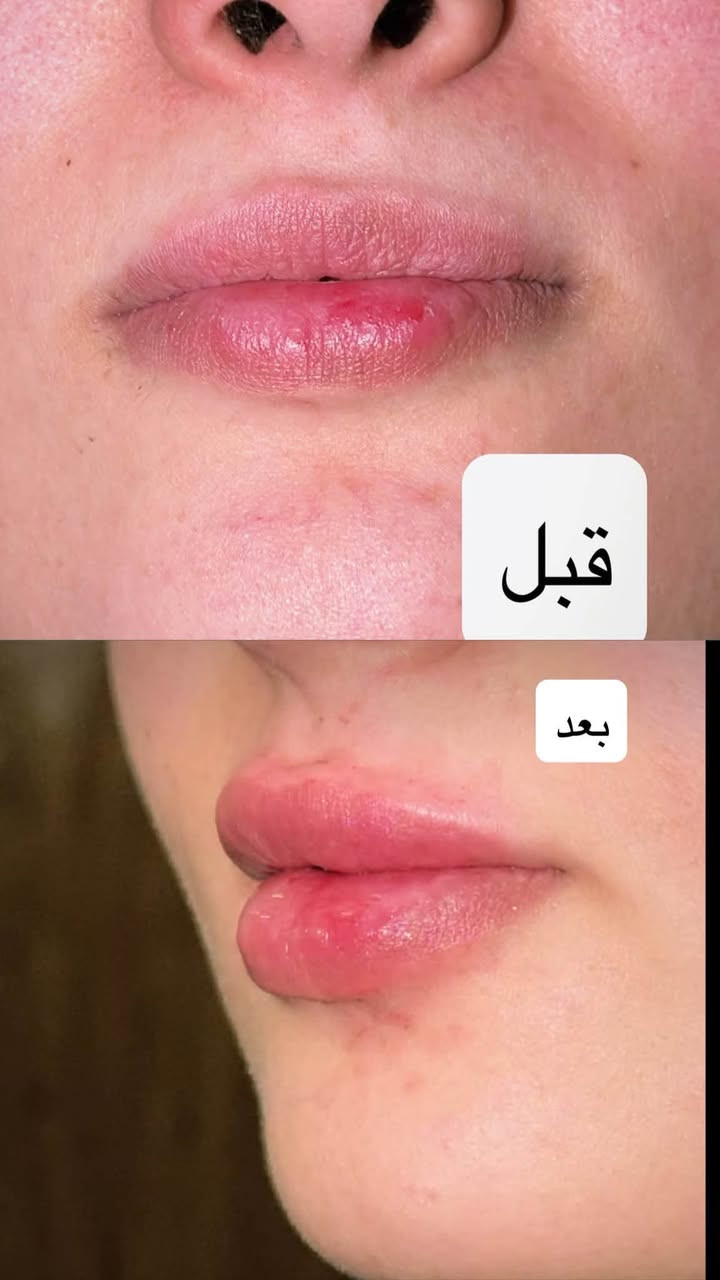 ننتضركم يوميا في عيادة كنز الابتسامه من الساعه ٥ للساعه ٩ مساءا للحجز والاستفسار واتس *********** عنوان العيادة نزلة گميره فوق صيدليه ليث صباح مقابل علوة ابو محمد
