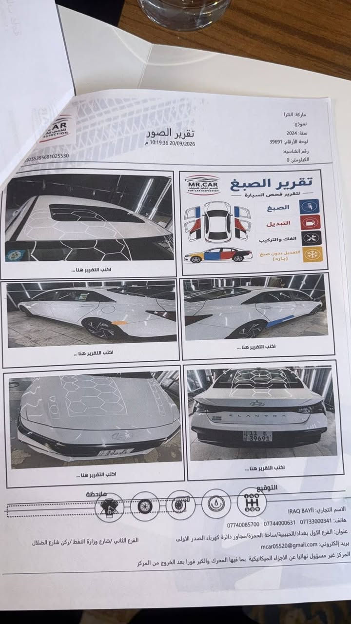 النترا ٢٠٢٤ خليجي
فول مواصفات ١ـ١ 
مكينه ٢٠٠٠ 
ماشيه ٥٠ الف 
سياره جديده بلكارتون ستوك على وضع الشركه 

١٦٩$ وبيهه مجال 

***********
