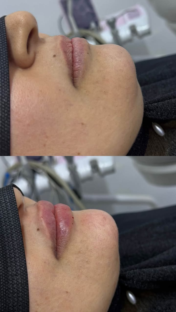 عيادة بتول • تجميل لاجراحي • البساتين