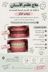 طقم أسنان كامل • مجاناً • كلية طب الأسنان
