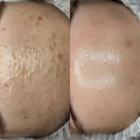 ✨ تنظيف البشرة العميق ✨ دلّلي بشرتچ وخليها تتنفس من جديد 🤍 تنظيف عميق ...