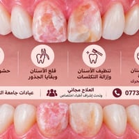مجاني • علاج اسنان • جامعة التراث
