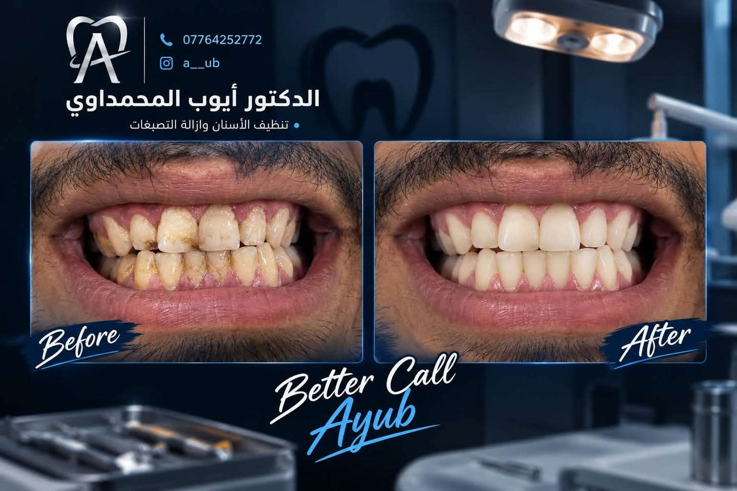 تركيبات أسنان • تنظيف وتبييض • علاج مجاني