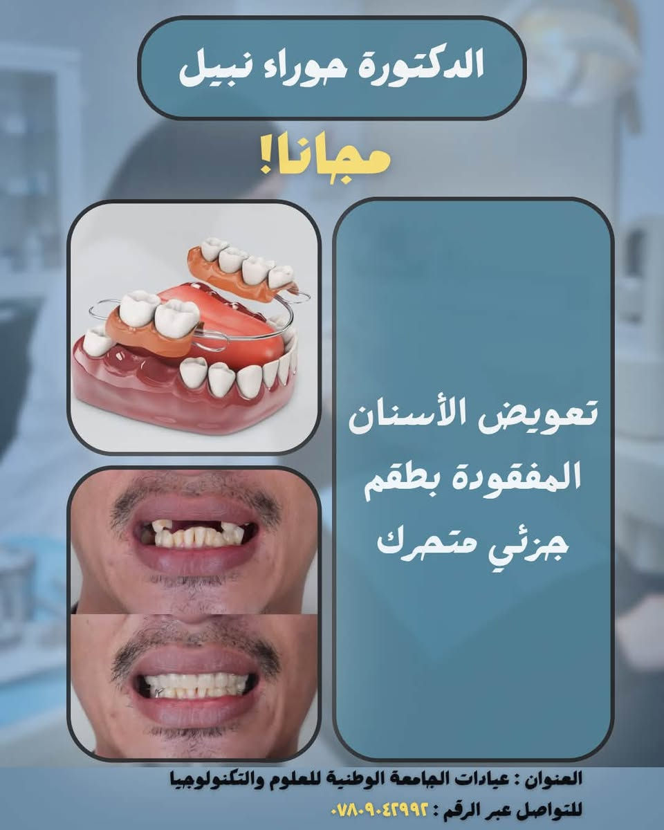 الدكتورة حوراء نبيل 

📌علاج الأسنان مجاناً بإشراف أطباء أسنان إختصاص 

الحالات والخدمات المتوفرة: 
• حشوات ضوئية
• قلع الأسنان والجذور المتبقية
• تعويض الأسنان المفقودة بطقم جزئي متحرك
• تنظيف الأسنان

📍العنوان : الناصرية - التضحية - عيادات الجامعة الوطنية للعلوم والتكنولوجيا

📞 للتواصل عبر الخاص او الرقم : ***********

نص مكتوب في الصور:
- الدكتورة حوراء نبيل مجاناً! BEFORE AFTER حشوات ضوئية العنوان : عيادات الجامعة الوطنية للعلوم والتكنولوجيا للتواصل عبر الرقم : ***********
- الدكتورة حوراء نبيل مجاناً! قلع الأسنان والجذور المتبقية العنوان : عيادات الجامعة الوطنية للعلوم والتكنولوجيا للتواصل عبر الرقم : ***********
- الدكتورة حوراء نبيل مجاناً! تعويض الأسنان المفقودة بطقم جزئي متحرك العنوان : عيادات الجامعة الوطنية للعلوم والتكنولوجيا للتواصل عبر الرقم : ***********
- الدكتورة حوراء نبيل مجانا! تنظيف الأسنان العنوان : عيادات الجامعة الوطنية للعلوم والتكنولوجيا للتواصل عبر الرقم : ***********