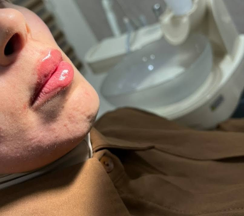 عيادة الدكتور وليد محمد الحمداني لطب الأسنان 🦷✅
هذا جزء بسيط من شغلنا 🔥🔥
للاستفسار أكثر مراسلة الصفحة ع الخاص 📲
او الاتصال على الرقم التالي *********** 📞
العنوان البياع شارع عشرين قرب دائرة الكهرباء مجمع البياع الطبي 🦷
