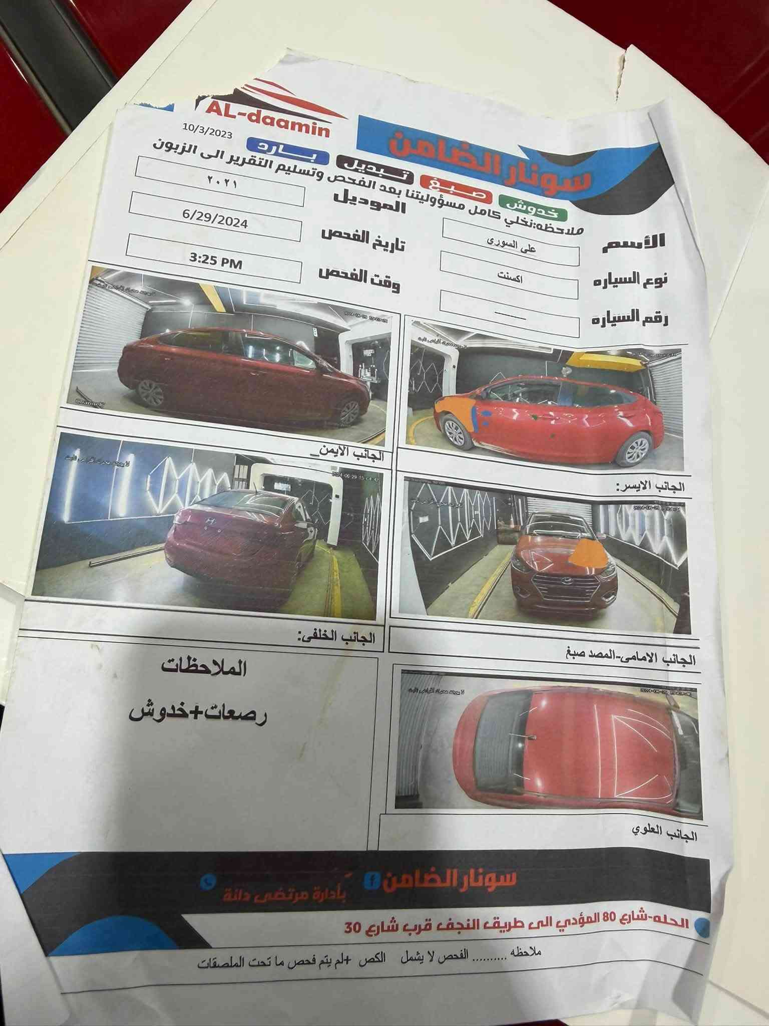 للبيع او المراوس
هونداي اكسنت 

الموديل :-2021
حادث السيارة :-صبغ جاملغ+ ربع البنيد (سونار مرفق بالمنشور)
كيرها At ومكينتها دوش كفالة 
السعر :115 وبيها مجال 
المكان :-بابل
للاستفسار :-***********
