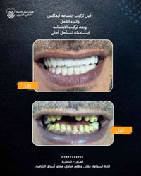 ابتسامة ايماكس • مركز نبض الحياة • فلكة السماوة