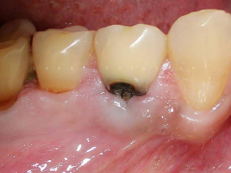 علاج مجاني • طقم متحرك • جامعة النور