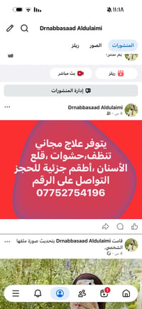 علاج مجاني • تنظيف وحشوات • طقم جزئي