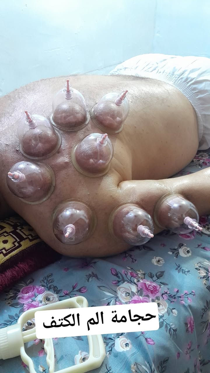 مركز المؤمل للعلاج الطبيعي والحجامه 

العنوان حي الصدرين قرب محلات علي دعيس 
مقابيل كماليات راهي 

قال الإمام الصادق (عليه السلام): «إذا ثار الدم بأحدكم فليحتجم، لا يتبيغ به فيقتله». 

الحالات التي يتم علاجها 
الفقرات العنقيه بواسطة العلاج الطبيعي والحجامه 
الفقرات القطنيه بواسطة العلاج الطبيعي والحجامه 
علاج عرق النسا 
علاج البواسير 
علاج الشقيقه 
علاج ارتفاع ضغط الدم 
علاج جرثومة المعده 
علاج الوثاب 
علاج العصب الوركي 
علاج الاصابات الرياضيه 
علاج الصره 
علاج القالون العصبي 
حجامه عامه للجسم 

الهاتف ***********
وات ساب ***********
