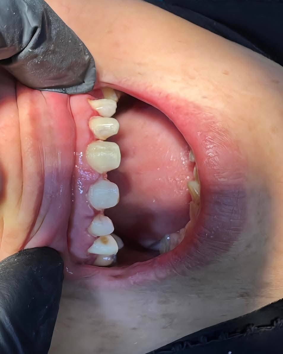 مجمع اهلنا النموذجي الطبي 
عيادة أونو 
لطب تجميل الأسنان 
بتواجد 
الدكتور محمد رحم الحجامي 
والدكتور احمد الصافي 
العنوان خلف سيد جعفر 
نهاية شارع الصناعي 
الديوانية قضاء البدير 
للحجز والاستفسار 
***********
