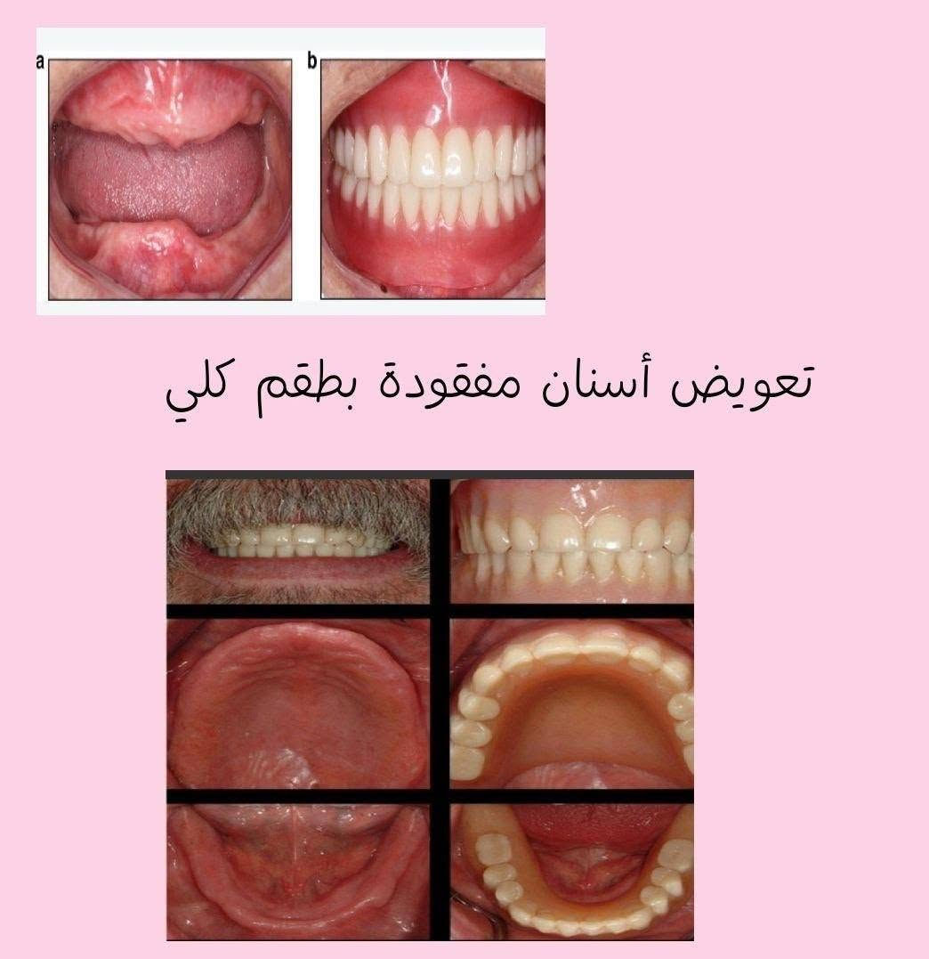 علاج مجاني • جامعة البيان • طب أسنان