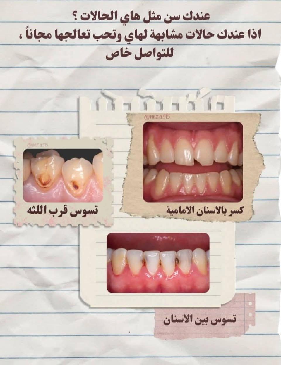 خدمات أسنان مجانية • قلع وجذور • كربلاء طريق الحر
