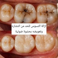 علاج أسنان • مجاني • كربلاء الحر الصغير