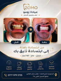 عيادة زومو • تجميل أسنان • المحمودية