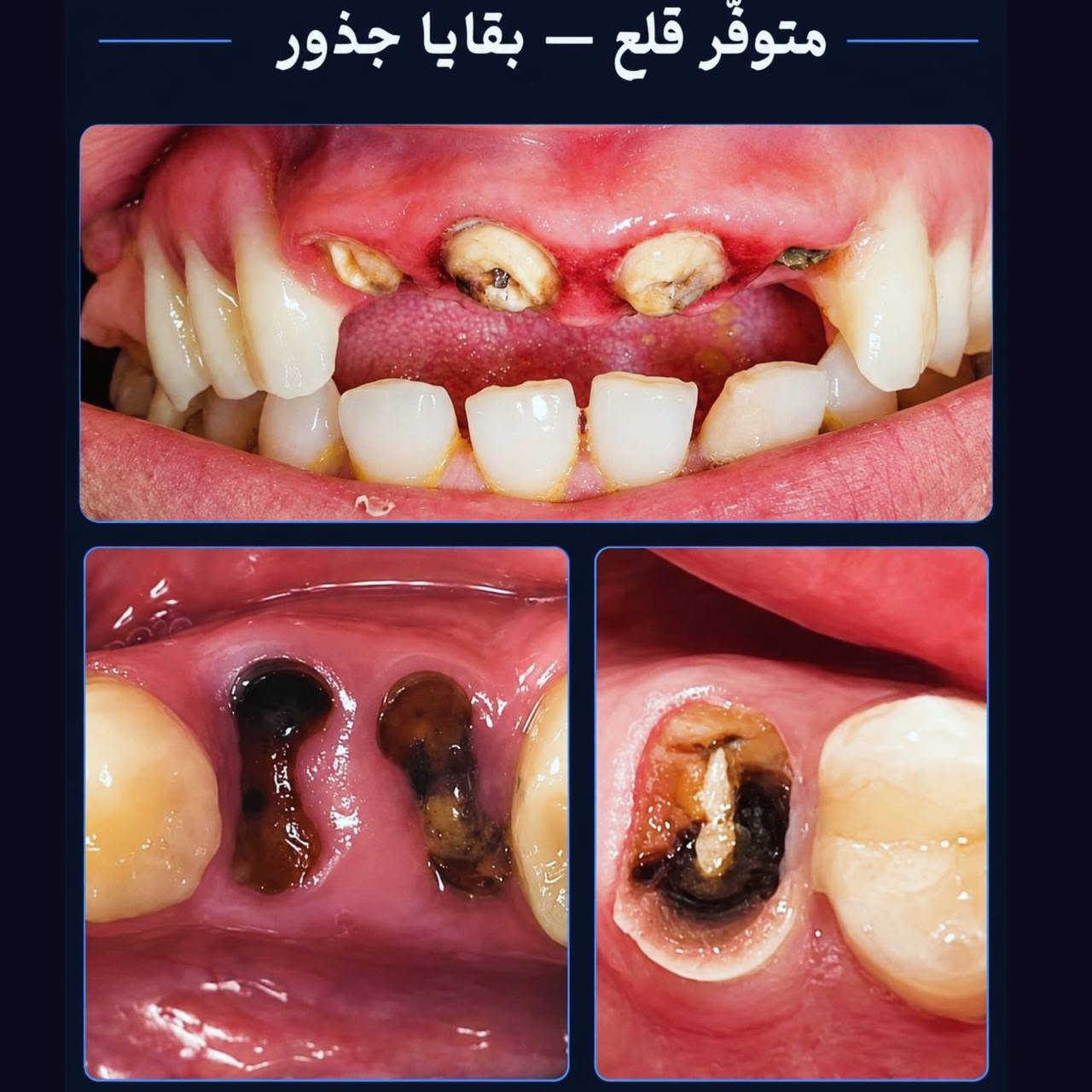 علاج مجاني • أسنان • السيدية بغداد