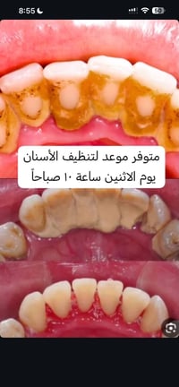 مجاناً • علاج أسنان • البصرة