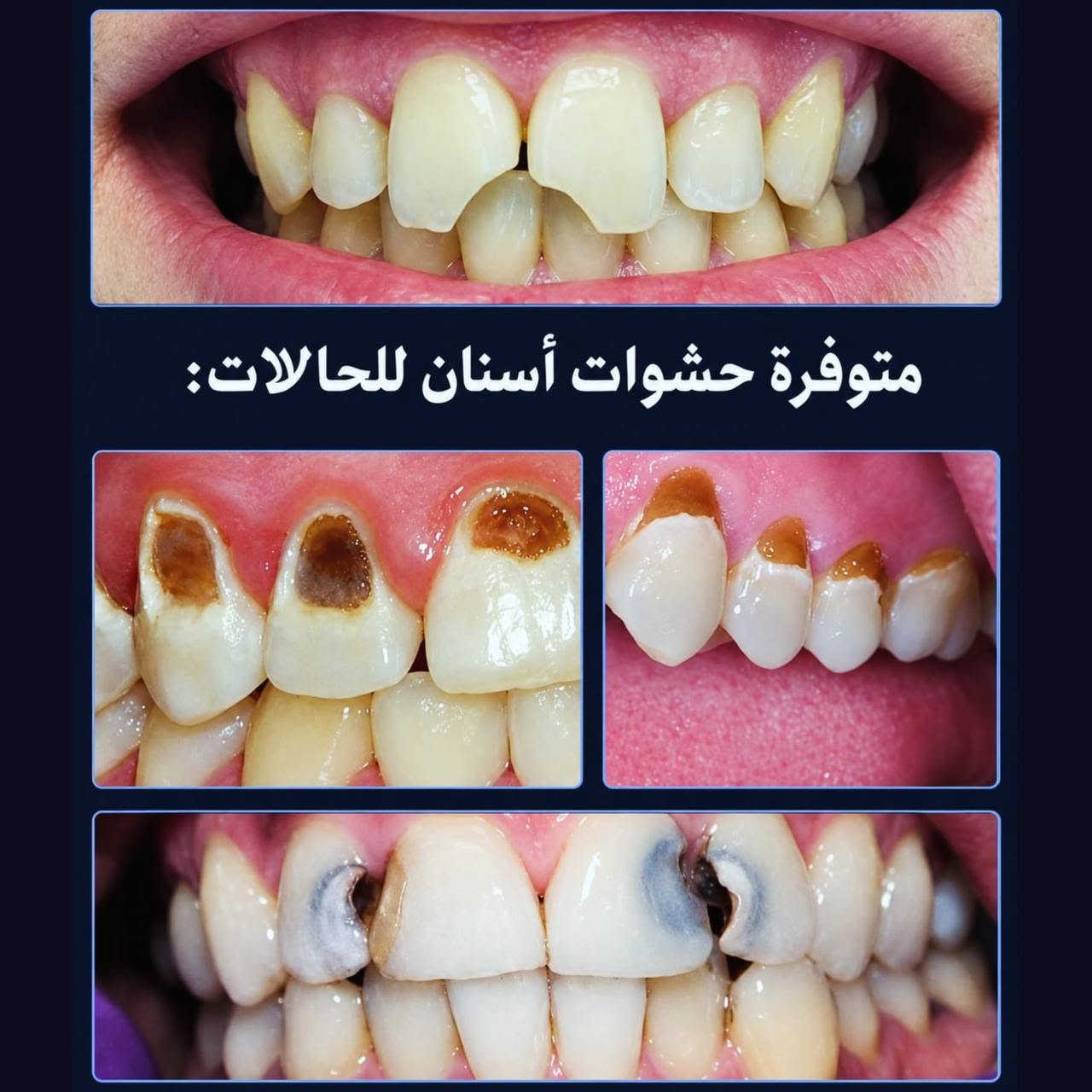 علاج مجاني • أسنان • السيدية بغداد