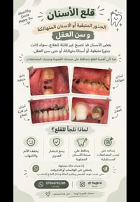 علاج أسنان • مجاني • بغداد شارع المطار