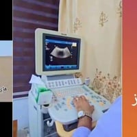 عيادة سونار • دوبلر ملون • شارع الدخالة ذي قار