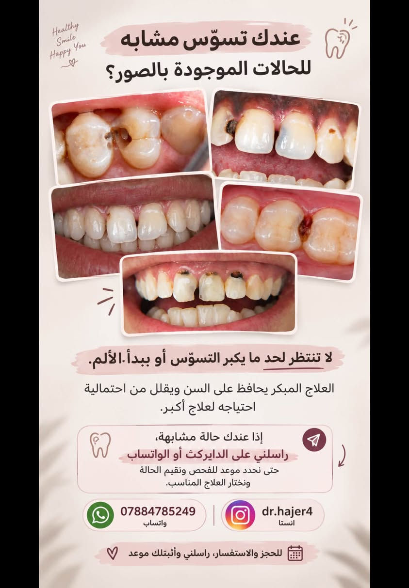 علاج أسنان • مجاني • بغداد شارع المطار