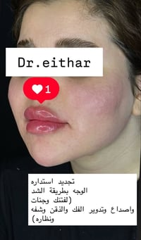 استدارة الوجه • ثالث مرة • مجمع القبطان