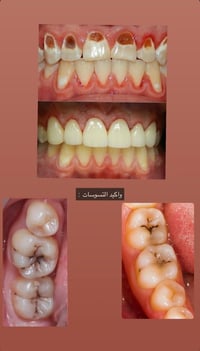 علاج أسنان مجاني • جامعة البيان • قرب مطار بغداد