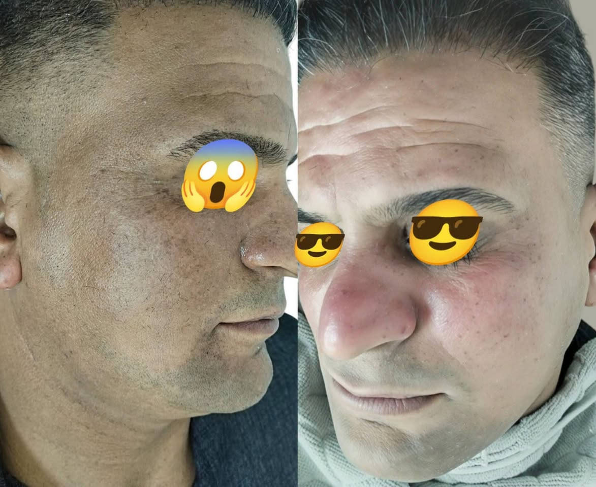 كمر✂️ في العراق و بسمايه ماخذ الاول دوووم 😎🤫
للحجز مراسلة الصفحه
واتساب ***********
واتساب ***********
الاوقات من اال8 صباحاً الى الساعه 8 مساءً
 دائماً في خدمتكم ❤️🇮🇶
