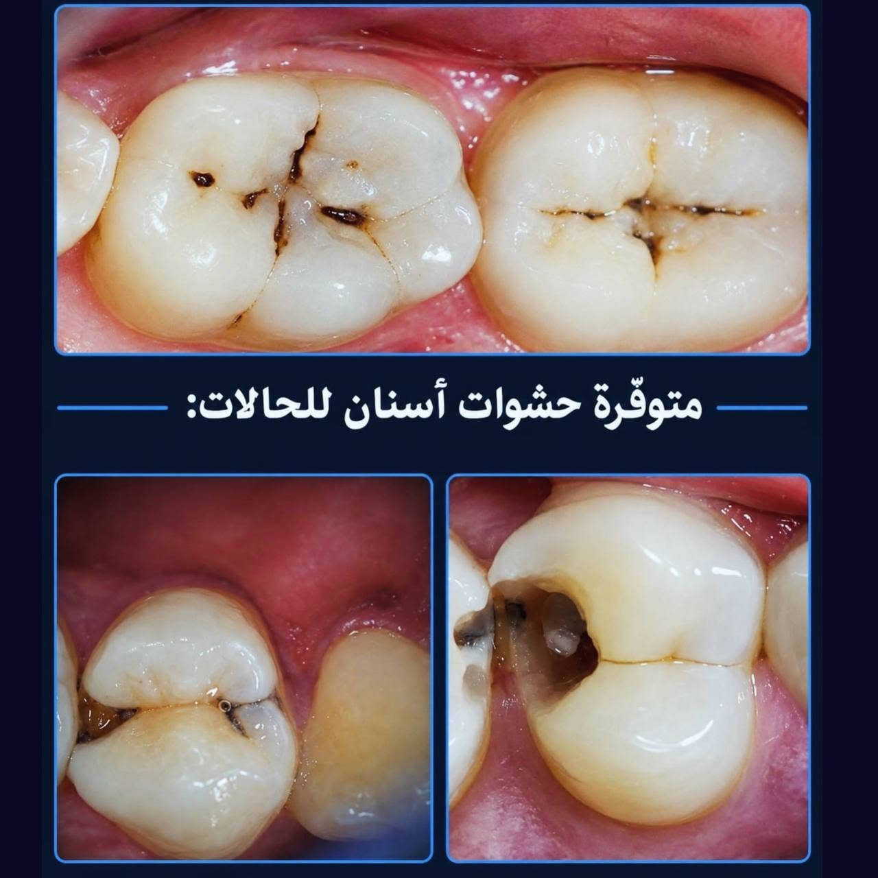 علاج مجاني • أسنان • السيدية بغداد