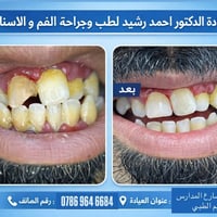 عيادة د. احمد رشيد لطب وجراحة الفم والأسنان 🦷✨ حيث تلتقي الخبرة الطبية...