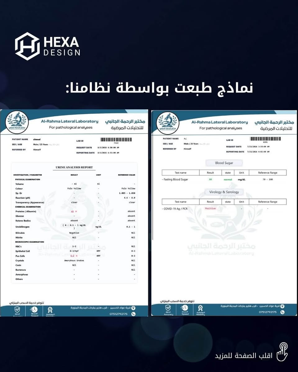 نظام CBC Pro الفريد من نوعه - من شركة Hexa
🕹️المميزات : 
- يعمل اوفلاين بالكامل 
- نظام سهل ومتكامل ويضم 456 فحص طبي قابل للزيادة والتعديل حسب مختبرك 
- النظام يدعم نظام التشغيل الوندوز 10 , 11 فقط 60bit حتى يشتغل بسلاسة
- امكانية انشاء فواتير واضافة فورماً بصيغة  image HD ، عالية الدقة  , 
- امكانية خرن ملفات وفواتير المرضى وسحبها بأي وقت , يدعم نظام الباقات ، يمكنك انشاء باقة تضم عدة فحوصات !  
- امكانية ارسال رسالة للمريض عبر الواتساب تخبره أن فحصه جاهز للإستلام 
- طباعة سهلة وبسيطة  
- خزن بيانات الفواتير والموردين وفواتير الشراء بالنقد والآجل 
- تحديثات مستمرة ، ودعم فني متواصل

للمزيد من التفاصيل راسلونا عبر الواتس آب 
‪***********‬

هدية مع النظام فورما + لوكو مجانا 
رابط المتجر : https://hexa.thewayl.com/product/cmsdb2sed001j0j8bnmr657b3
