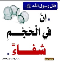 حجامة للنساء • إزالة أملاح • القائم حي التنك