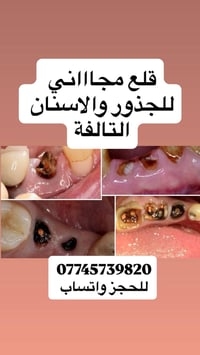 مجاناً • قلع جذور واسنان • جامعة البيان