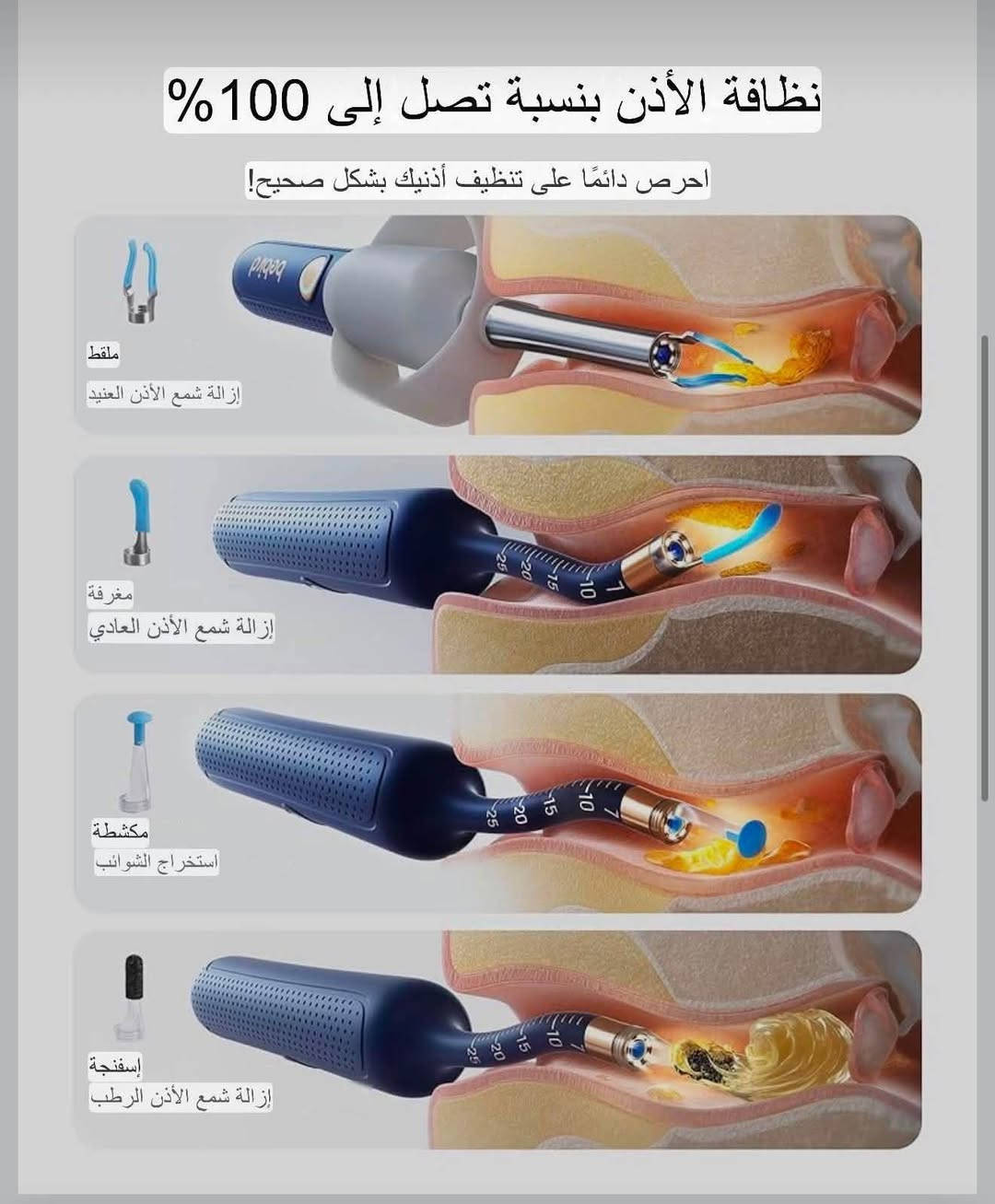 جهاز تنظيف الاذن الاحترافي ماركة bebird توفر💐
 
كاميرا Bebird Earsight Plus R37R لإزالة شمع الأذن، منتجات مؤهلة لبرنامج FSA HSA، 
منظف أذن ذكي مع ملاقط بصرية غير مؤلمة، 
منظار أذن مرن مزود بكاميرا، 
طقم تنظيف منزلي للأنف والأذن والحنجرة للعائلة، 

كاميرا تنظيف الأذن الذكية المصممة خصيصًا لأذنيك: ليست كل كاميرات الأذن متساوية! تم تصميم منظار الأذن الرقمي المرن والقابل للطي ليناسب الانحناءات الطبيعية لقناة أذنك، مما يجعل الفحص والتنظيف أسهل من أي وقت مضى. بالإضافة إلى ذلك، مع كاميرا عالية الدقة مقاومة للماء والغبار والضباب بتقنية 3P، ستحصل على رؤية داخلية مذهلة!

السلامة والراحة التامة: السلامة أولًا! يضمن الطلاء السيليكوني الناعم عدم وجود خدوش أو إزعاج، وتبقى رؤوس التنظيف ثابتة في مكانها أثناء الاستخدام - لا داعي للقلق بشأن سقوطها. يمنع مقياس الأمان المدمج والسدادة الواقية الإدخال الزائد، مما يحافظ على سلامة طبلة أذنك أثناء التنظيف.

ملقط أذن مزود بكاميرا بدون ألم: يزيل هذا الملقط المرئي الدقيق المزود بكاميرا شمع الأذن بلطف دون لمس قناة الأذن، مما يجعله مثاليًا للأذنين الحساسة أو الأذنين الصغيرتين الرقيقتين. إذا كنت ترغب في تنظيف لطيف وغير مؤلم، فإن ملقط الأذن المزود بكاميرا هو الحل الأمثل.

مجموعة تنظيف الأذن المثالية: مجموعة متكاملة للاستخدام المنزلي والسفر! مع 4 أنواع من رؤوس التنظيف المتينة، تُعدّ مثالية للأذنين الرطبة والجافة، مما يضمن تنظيفًا شاملاً في كل مرة. بالإضافة إلى ذلك، تتضمن المجموعة أدوات فحص الأذن والأنف والحنجرة، مما يجعل الفحوصات المنزلية سهلة للغاية، ويوفر عليك المال والجهد. علبة التخزين المدمجة مثالية للسفر - خذها معك أينما ذهبت!

تنظيف الأذن بطريقة ممتعة: إنها ليست مجرد أداة تنظيف - إنها ممتعة للغاية! سيستمتع الكبار براحة تنظيف شمع الأذن، بينما سينبهر الأطفال ولن يخشوا العناية بأذنهم بعد الآن. إنها ممتعة لجميع أفراد العائلة!

جديدة 👍
السعر ٤٠ الف 💐

🥀تابع الصفحة ليصلك كل جديد🥀

للحجز والاستفسار المراسلة بالخاص او رقم واتساب ***********💐

نص مكتوب في الصور:
- منظار الأذن المرن يناسب بشكل أفضل قم بثنيه وتشكيله يناسب قناة أذنك يوفر رؤية فائقة الوضوح مقاوم للماء. مقاوم للغبار. مقاوم للضباب عدسات بصرية ثلاثية الطبقات لرؤية أكثر وضوحا
- ملقط أذن بدون ألم الخيار الأمثل للأذنين الحساسة وقنوات الأذن الرقيقة للأطفال دقيق يزيل بقايا الأذن دون لمس الجلد
- نظافة الأذن بنسبة تصل إلى 100% احرص دائما على تنظيف أذنيك بشكل صحيح! ملقط إزالة شمع الأذن العنيد مغرفة إزالة شمع الأذن العادي مكشطة استخراج الشوائب إسفنجة إزالة شمع الأذن الرطب
- مثالي للكبار والصغار
- انظر بوضوح، نظف بثقة!
- تنظيف ذاتي
- للأطفال
- للأزواج
- مستلزمات الفحص المنزلي افحص آذان وأنف وأسنان وحلق أطفالك فحص الأذن فحص الأنف فحص الفم