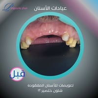 بلاتينيوم كلينك • عيادات أسنان • المحمودية