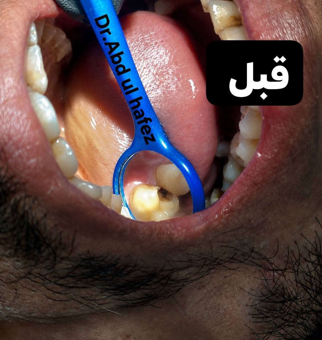 مجاني • طالب طب أسنان • مستشفى دجلة