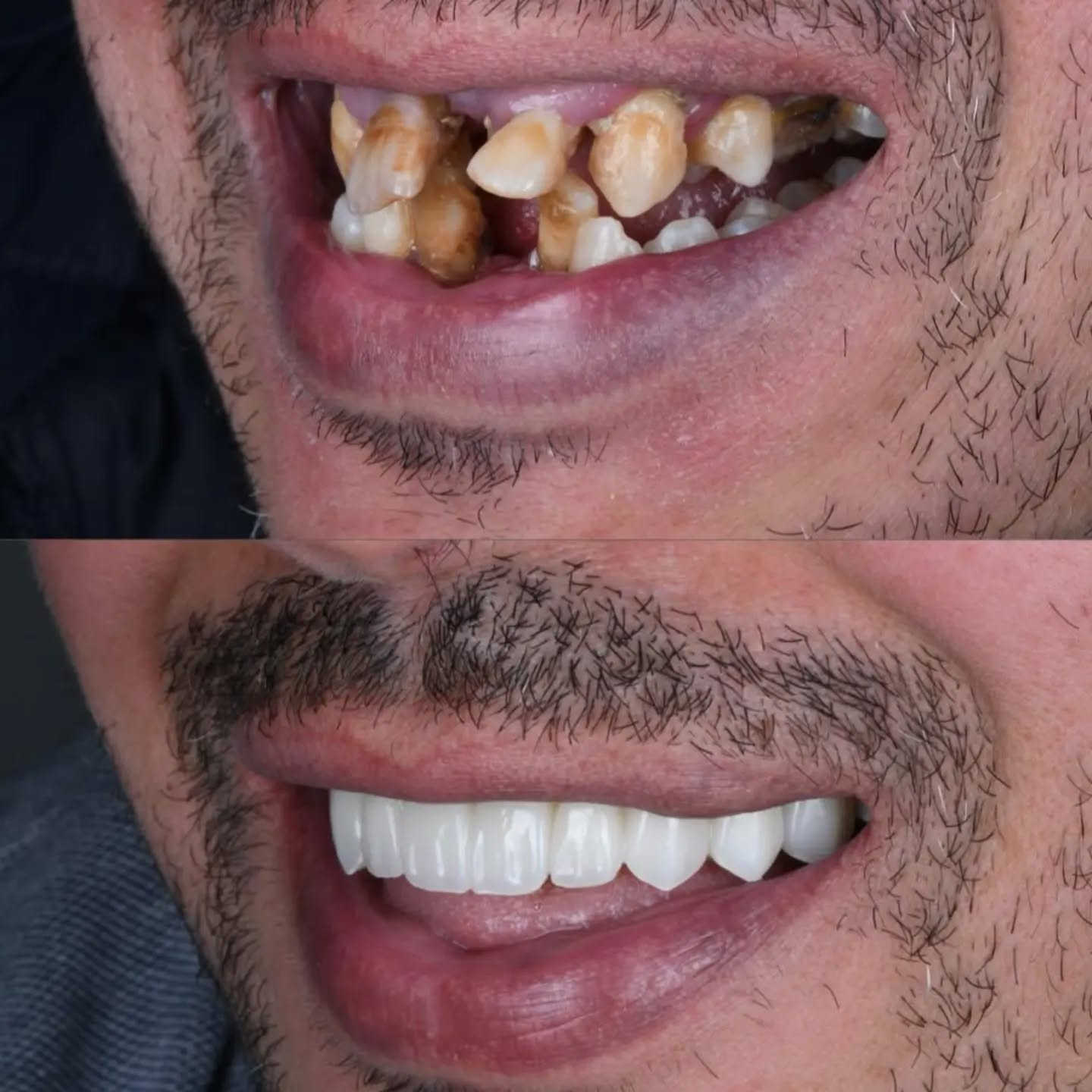 ابتسم بكل ثقة في مركز اسد التخصصي 
العنوان بغداد المدائن شارع الاطباء مقابل مجمع البيت الاصفر 
***********
