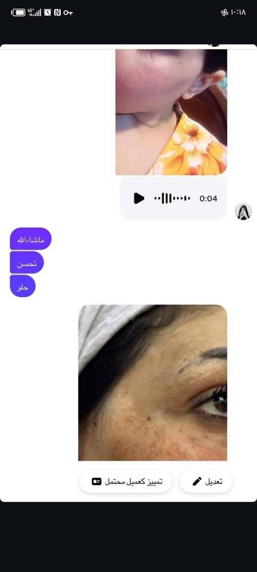 بنات العرض ع الخلطه الايرانيه العشبيه
٢٠ والتوصيل مجاني لحد الجمعه ويخلص العرص

نص مكتوب في الصور:
- In quiet mode هاي بعدنه ماكملت لا شهر ولا العلبه كلها بالكامره الاماميه مالت لايفون ماشاءالله تخبل تخبل حبيبي الفضل الج اكيد جانت دهنيه بشكل هسه متوازنه وتخبل عافيات هوه حلو بي يوازن دهون منع حبوب
- ماشاءالله تحسن حلو تمييز كعميل محتمل تعديل
- ورغم الكلف كلش كان قوي وغامق شوفي الفرق بين صورتين
- الله
- تدللين حياتي
- ماشآء الله وجهها مثل الورد صار الفضل الله والج بدون مجامله جان يلعب النفس
- واني لو تشوفين وجهي ماشآء الله
- مليون عافيه عليكم ياربي
- صلوات
- نعم تركيزة اقوة Unread messages كون وجهي يسمن بسرعه قبل شهر اخذت من عندج كبسول مبيض يجنن سو البياض عندي جنت حيل سمره هسه ماشاء الله يجنن واريد مصداقيتج بتسمين وجهي فدوه دكتوره
