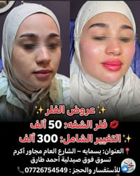 ✨انتي جميلة بس ويانه رح تصيرين اجمل✨    #بعياده تــდــــوته كراند. توت...