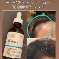يجنن لكثافة الشعر