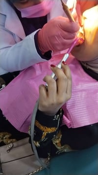 علاج اسنان مجاني • حشوات تجميلية • دكتورة آيات