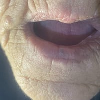 تركيب طقم • مجاني بالكامل