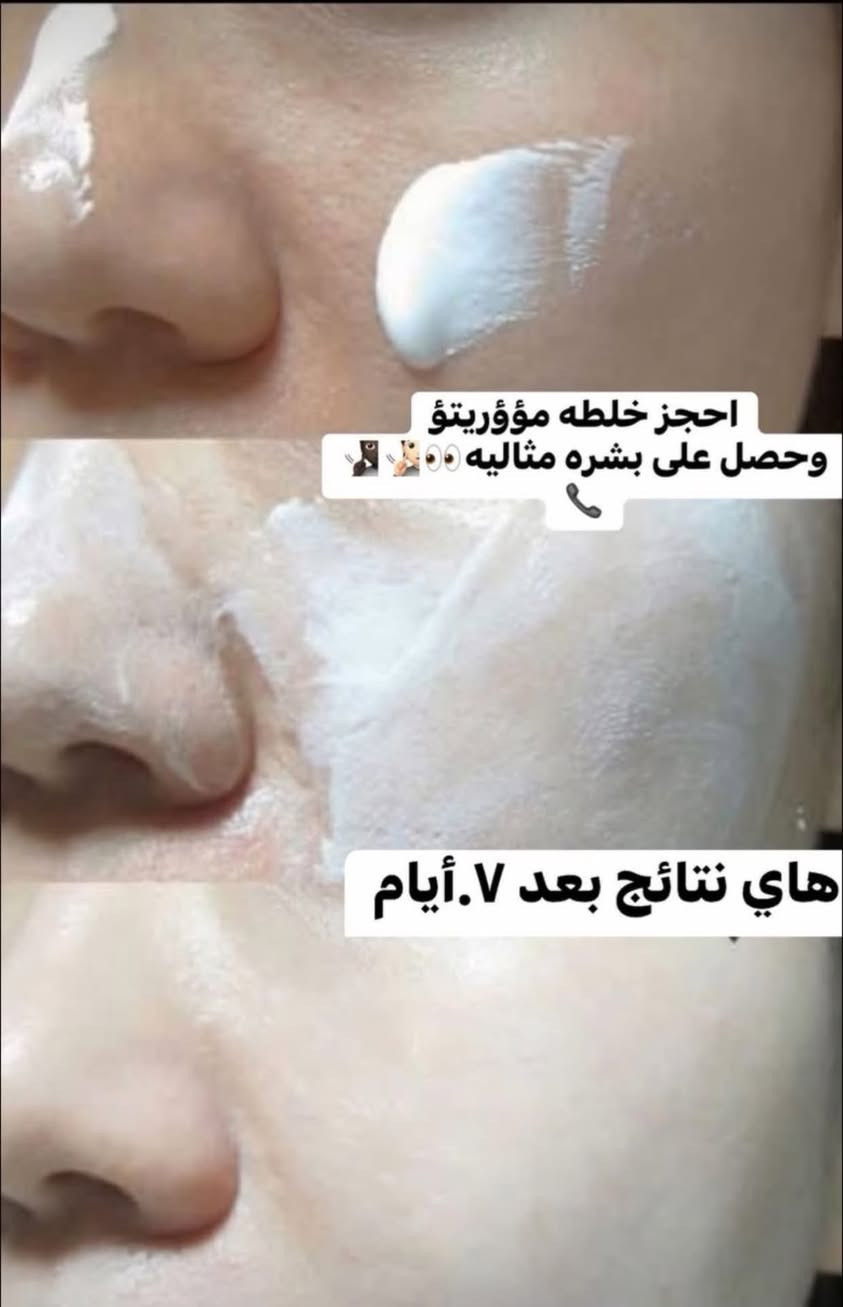 بشرتك تعبانه 🧔🏻‍♀️🧔🏻‍♀️
ماعليك بس تحجز 📞📞📞📞
***********
صالون مؤوريتؤ للعنايه بلشعر والبشره 
العنوان. ناصريه. قضاء النصر. خلف مستوصف الزهراء
