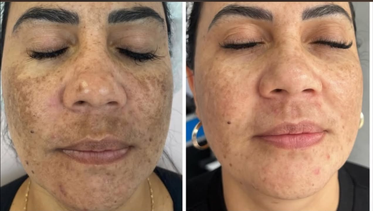 تركيبة ميلانين • تصبغات عميقة • مرطب ومغذي