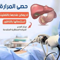 قص المعدة • تحويل مسار • النجف الاشرف